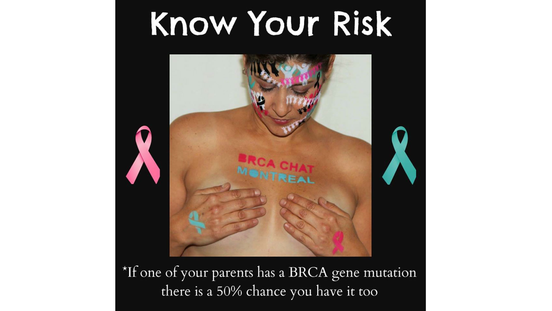 male breast cancer
